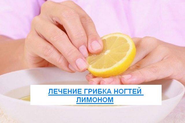 Лимон от грибка ногтей на ногах и руках: отзывы, рецепты