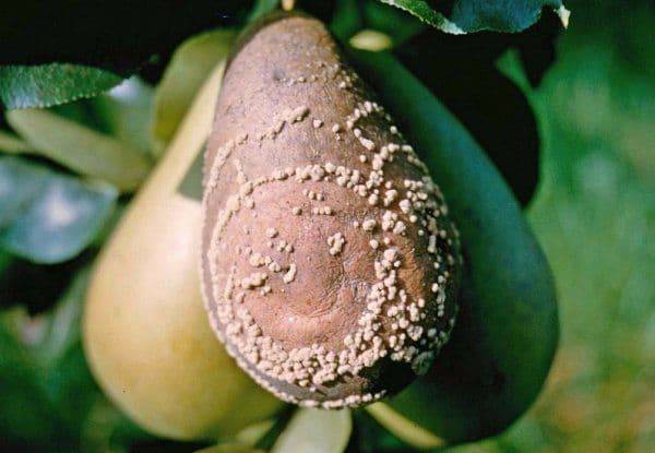 Замирание плода | причины и как предотвратить замирание плода? | компетентно о здоровье на ilive